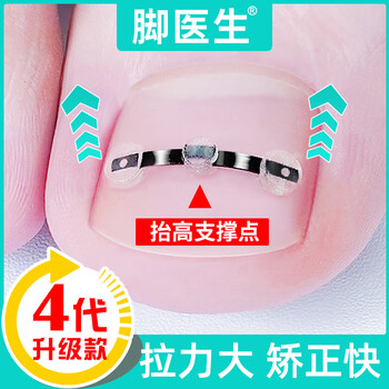 Dr.JYS甲沟炎矫正器镍钛合金正甲贴片嵌甲专用脚趾甲长肉里足部固定器
